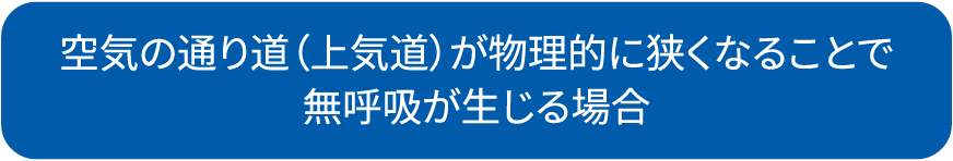 閉塞：空気の通り道（上気道）が物理的に狭くなることで無呼吸が生じる場合。